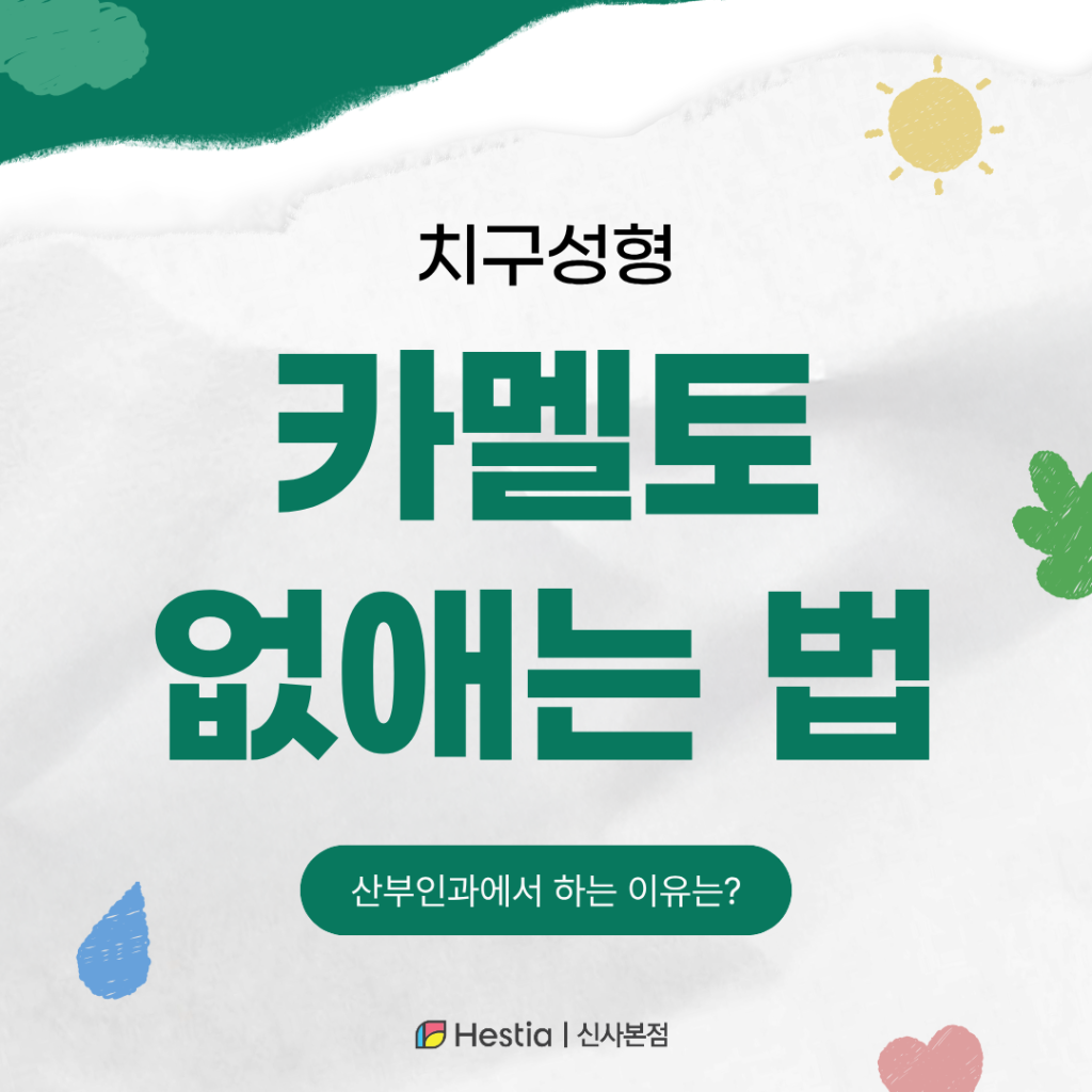 1_Y존 부각