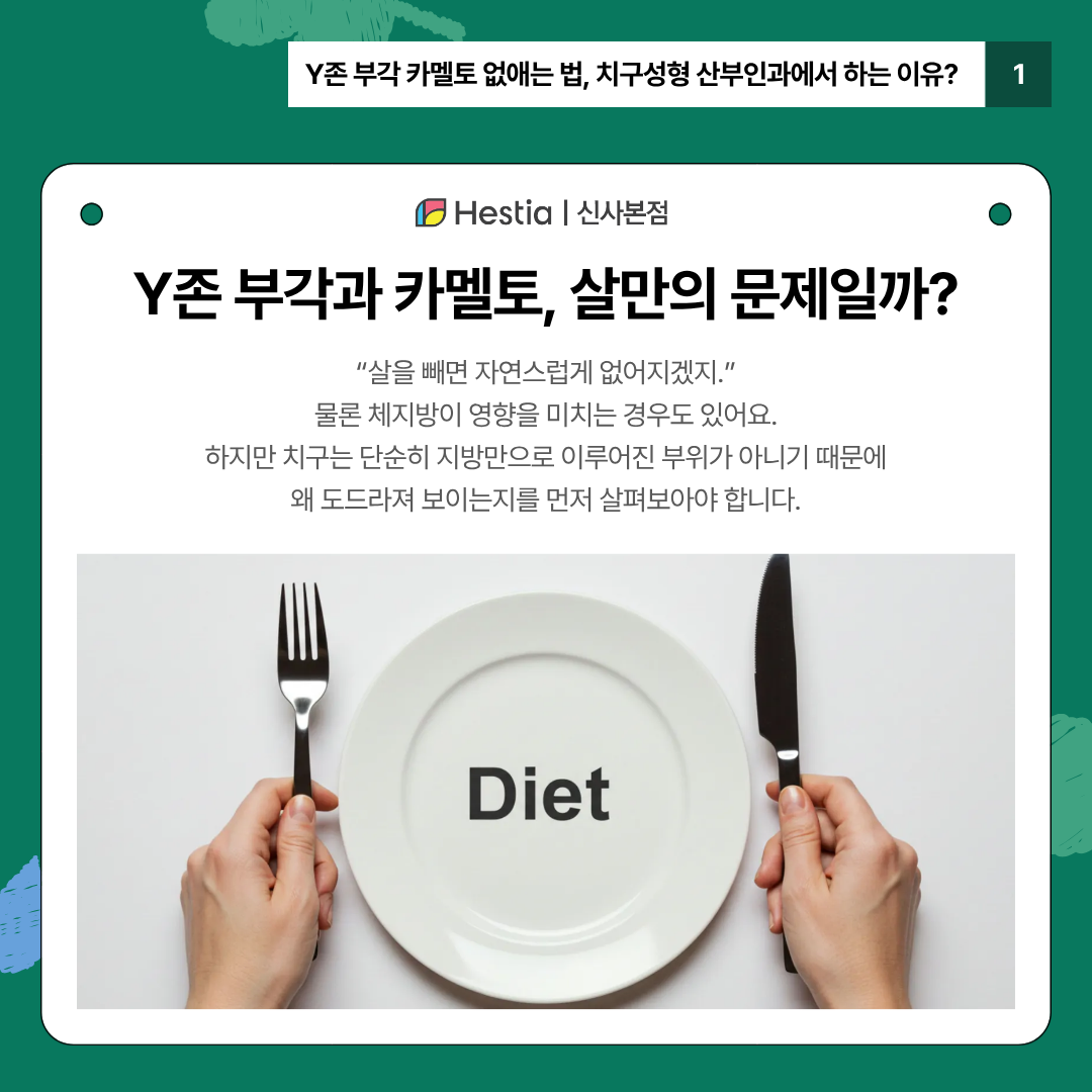 2_Y존 부각