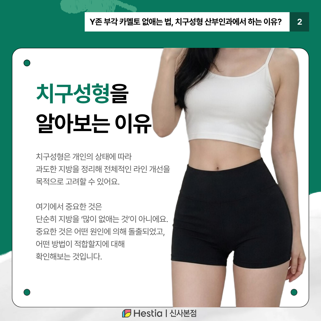 3_Y존 부각
