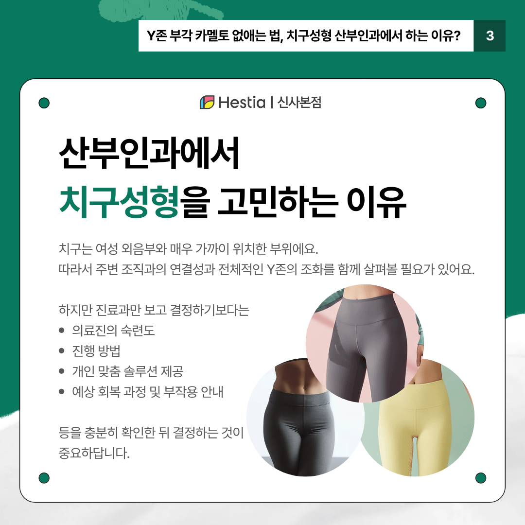 4_Y존 부각
