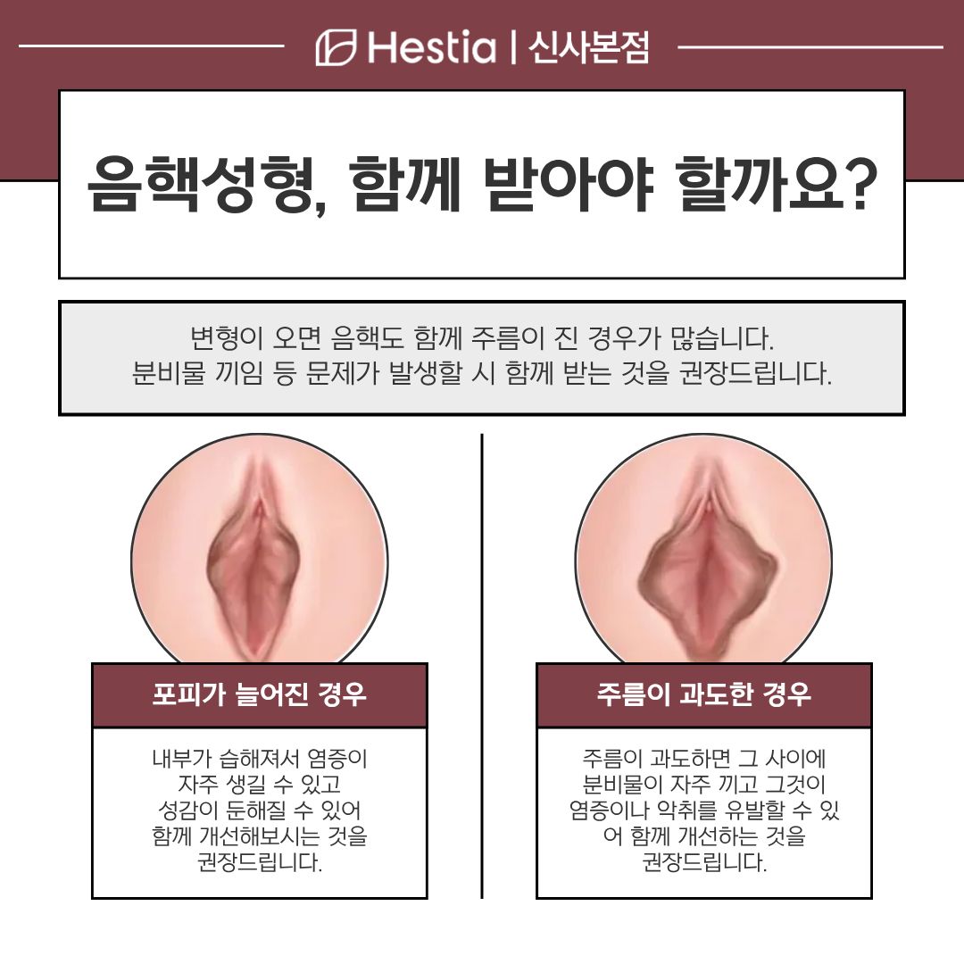 음핵성형 필요한 순간