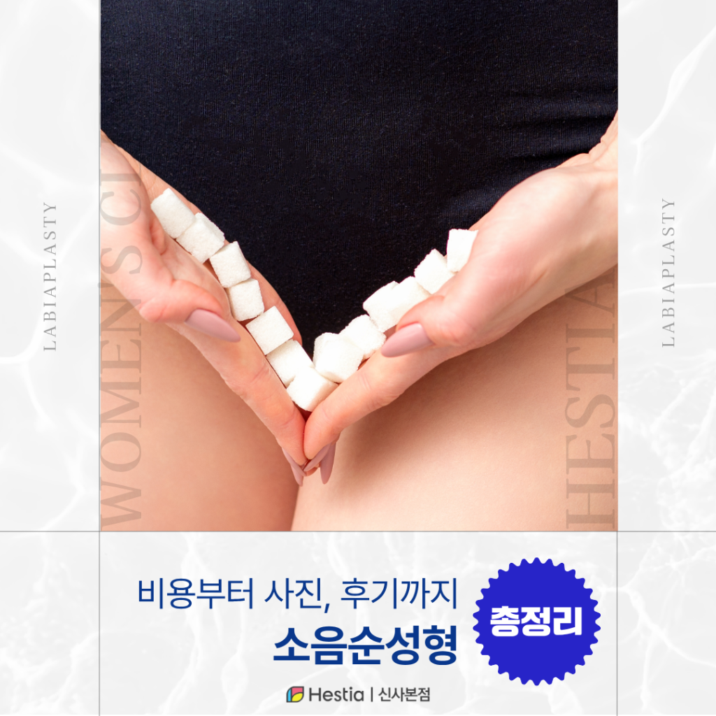 1_소음순성형