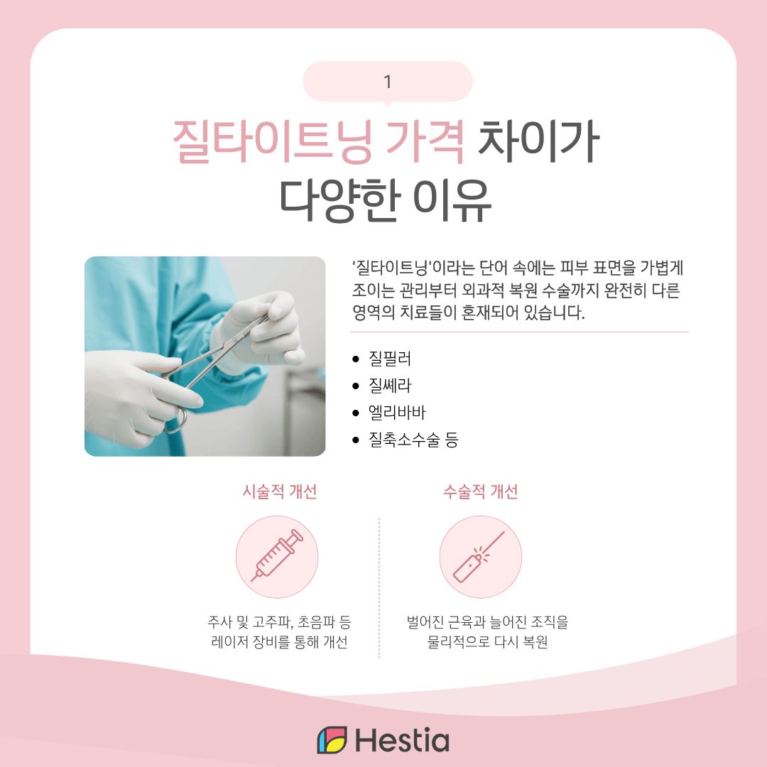 질타이트닝 가격 차이가 수백만 원씩 벌어지는 3가지 이유