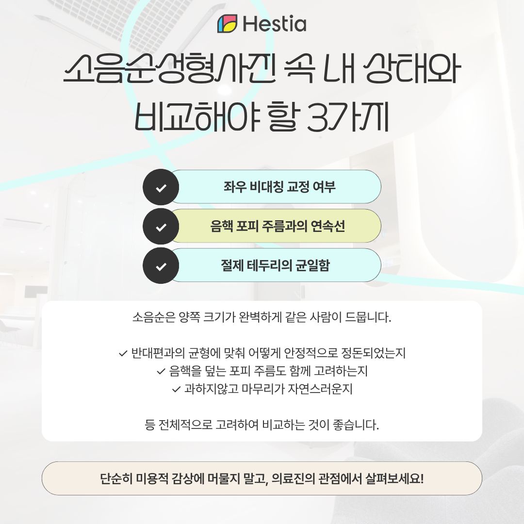 소음순성형사진 후기를 읽을 때 판별해야 할 3가지 필수 기준