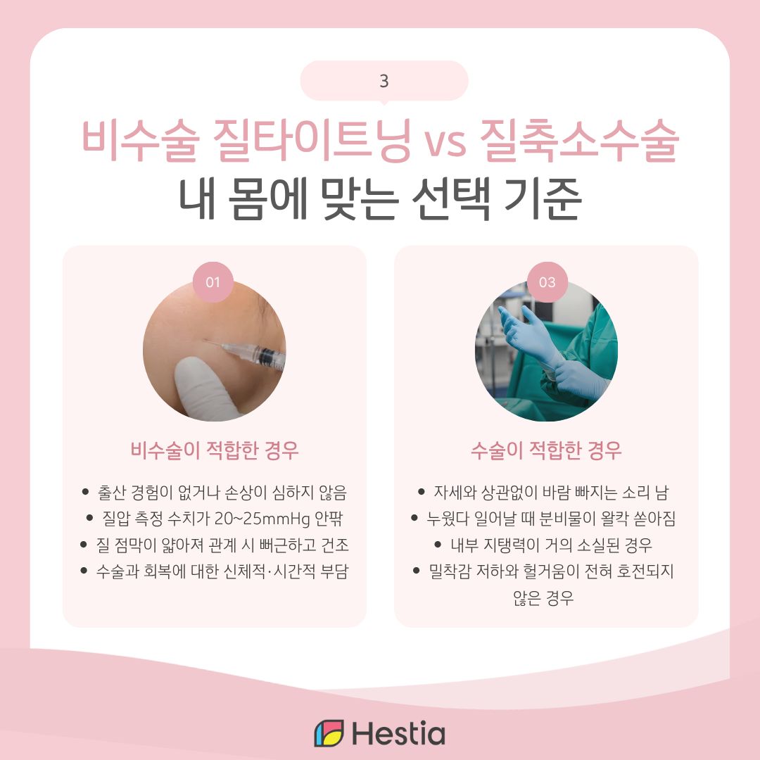 질방귀나 밀착감 저하, 고가 시술이나 질성형이 필요할까?