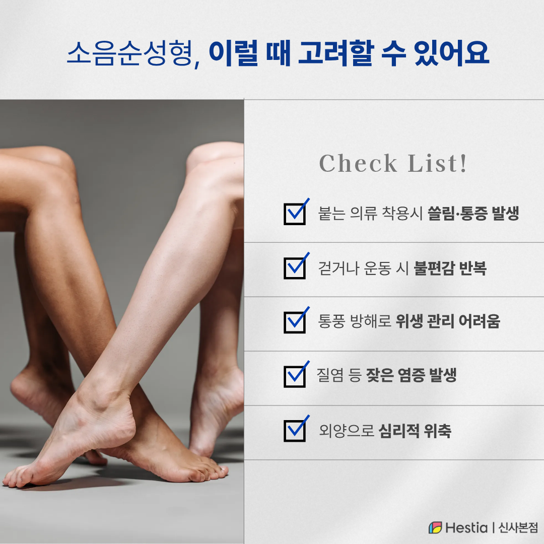 4_소음순성형
