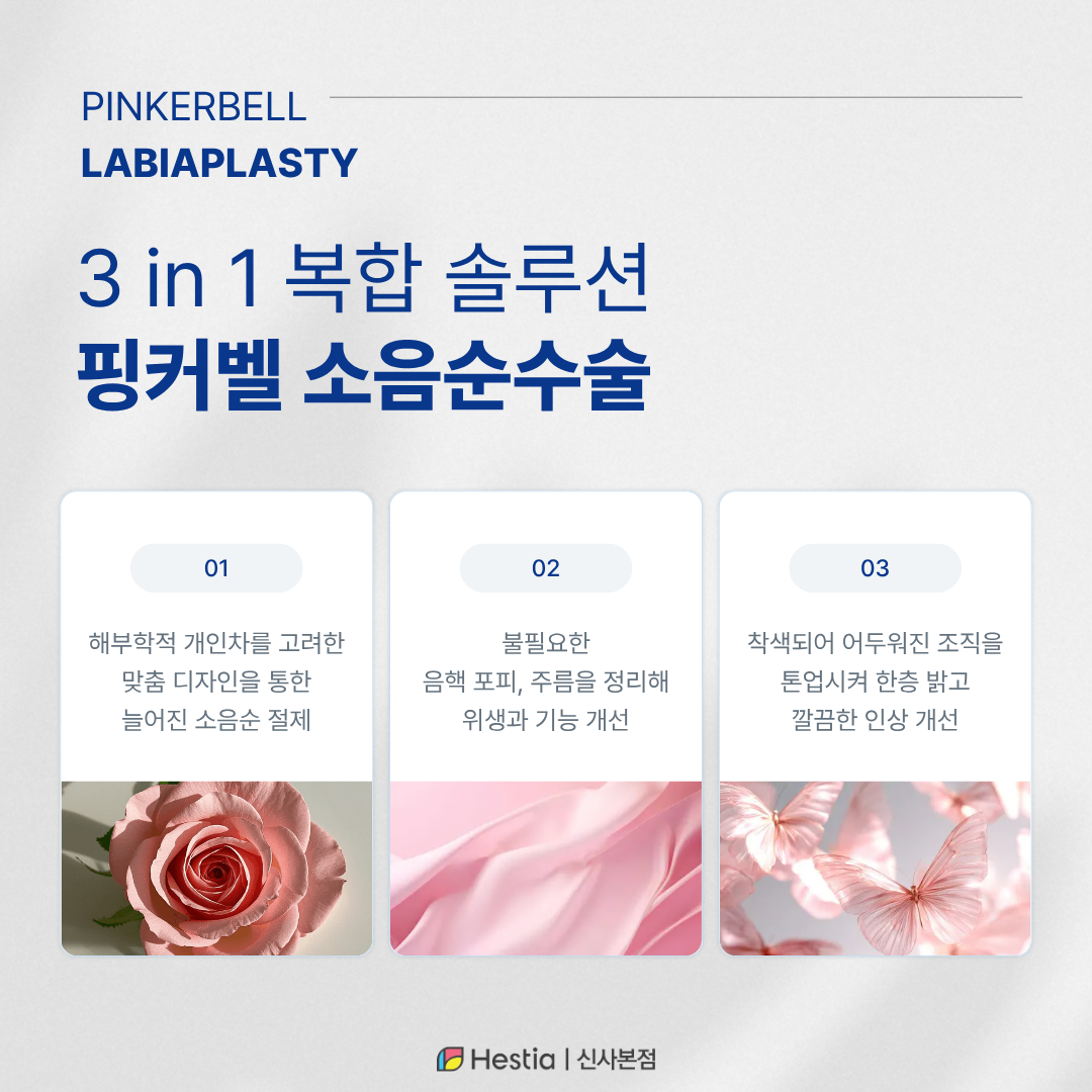 5_소음순성형