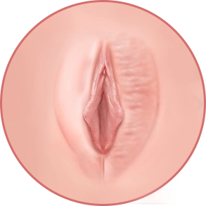 비대칭 / 비대한 대음순
