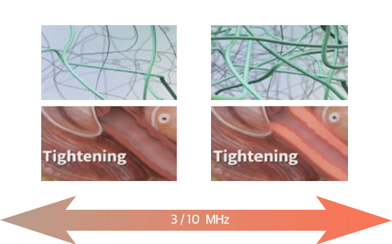 Volumetric Heating